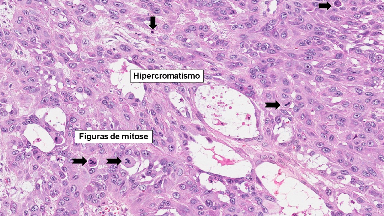 MITOSE - Histologia I